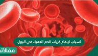  اسباب ارتفاع كريات الدم الحمراء في البول