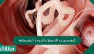 كيف يصاب الانسان بالدودة الشريطية وما طرق علاجها والوقاية منها