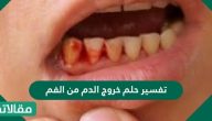 تفسير حلم خروج الدم من الفم