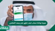 صورة توكلنا مصاب كيف تظهر قبل وبعد التعافي