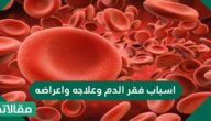 أسباب فقر الدم وعلاجه وأعراضه
