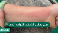 هل يمكن الشفاء التهاب الدم ، وما مدى خطورته ؟
