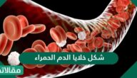 شكل خلايا الدم الحمراء