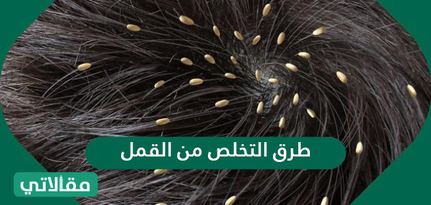 طرق التخلص من القمل