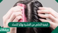 كيفية التخلص من القشرة نهائيًا للنساء