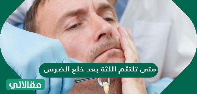 متى تلتئم اللثة بعد خلع الضرس