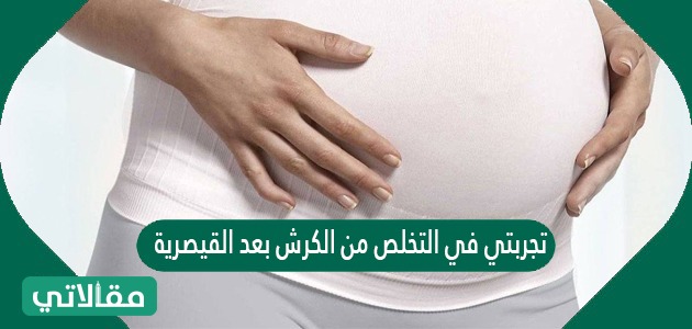 تجربتي في التخلص من الكرش بعد القيصريه