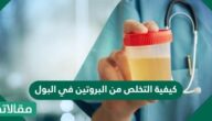 كيفية التخلص من البروتين في البول