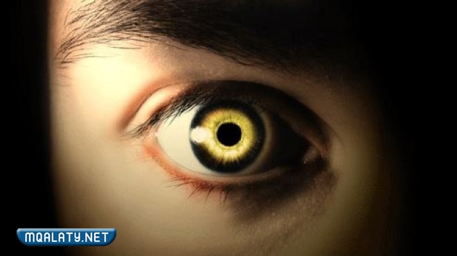 علامات الحسد في الزواج