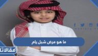 ما هو مرض شبل يام