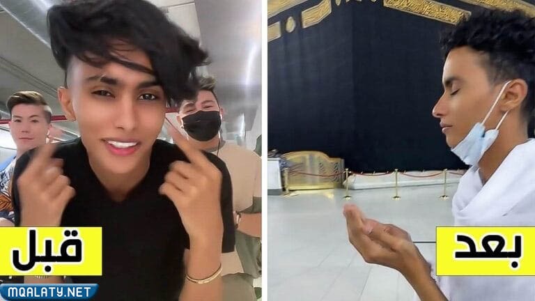 المودل هيما قبل وبعد