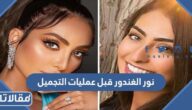 صور نور الغندور قبل وبعد عمليات التجميل