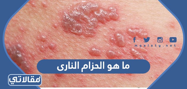 ما هو الحزام النارى