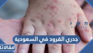 حقيقة وجود حالات جدري القرود في السعودية