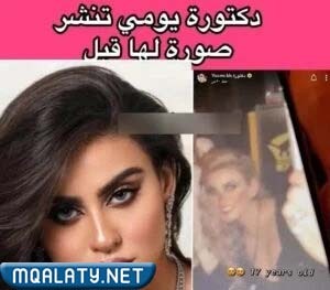 دكتورة يومي قبل وبعد