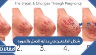 شكل الحلمتين في بداية الحمل بالصورة