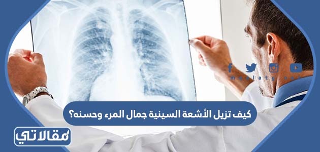 كيف تزيل الأشعة السينية جمال المرء وحسنه؟