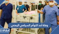 حقيقة وفاة أحد التوأم السيامي اليمني