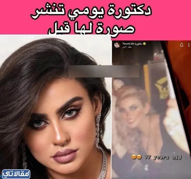 دكتورة يومي قبل وبعد