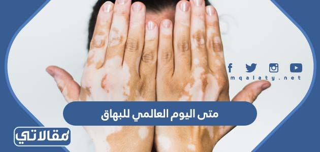 متى اليوم العالمي للبهاق