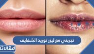 تجربتي مع ليزر توريد الشفايف