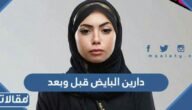 دارين البايض قبل وبعد