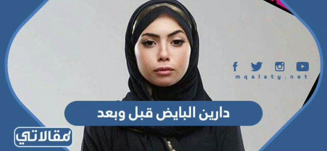دارين البايض قبل وبعد