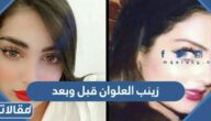زينب العلوان قبل وبعد