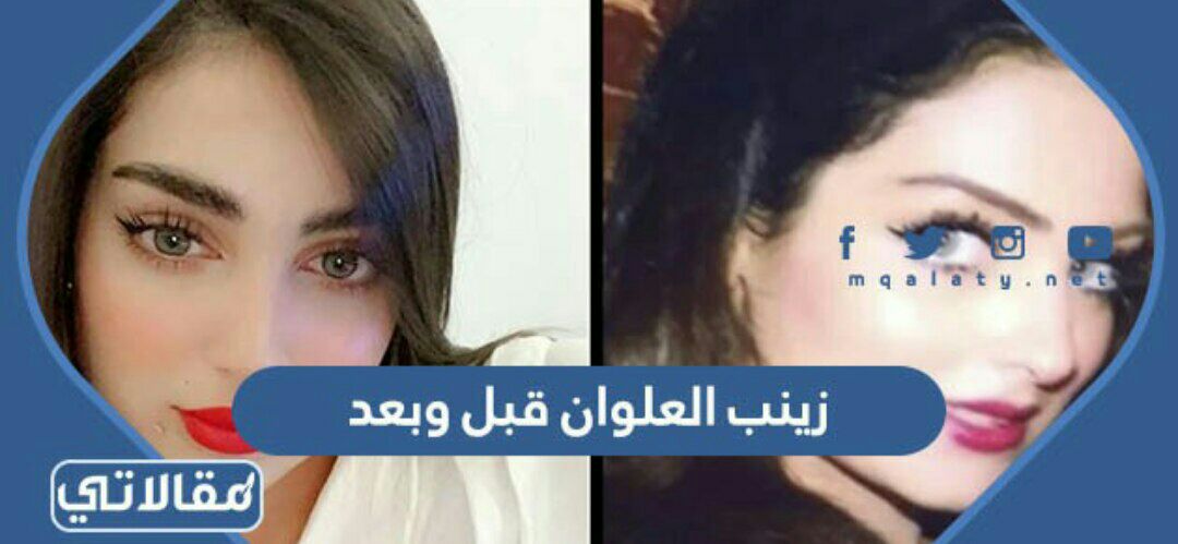 زينب العلوان قبل وبعد