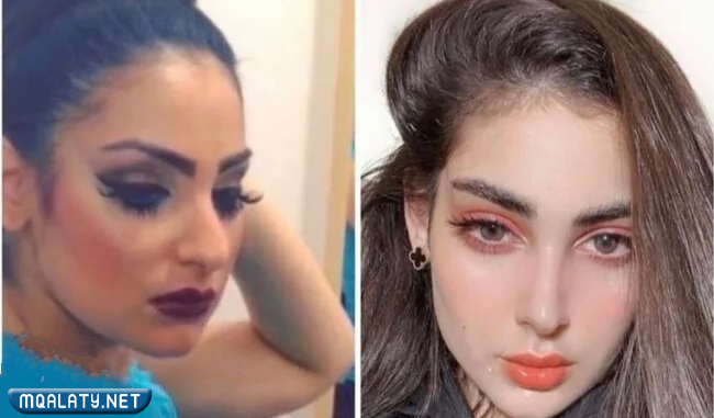 زينب العلوان قبل وبعد