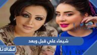 شيماء علي قبل وبعد