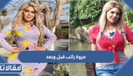 صور مروة راتب قبل وبعد عمليات التجميل