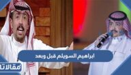 ابراهيم السويلم قبل وبعد عملية التكميم