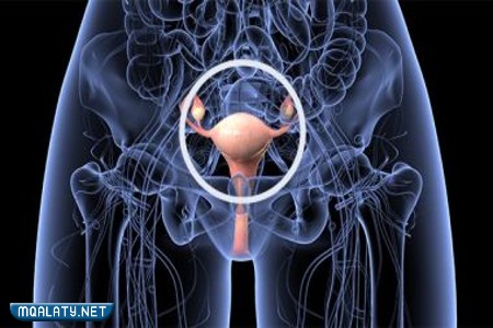 تقوية عضلات الحوض لإرجاع الرحم إلى مكانه