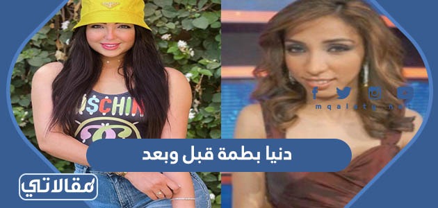دنيا بطمة قبل وبعد