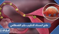 علاج انسداد الانابيب جابر القحطاني