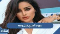 عهود العنزي قبل وبعد عمليات التجميل