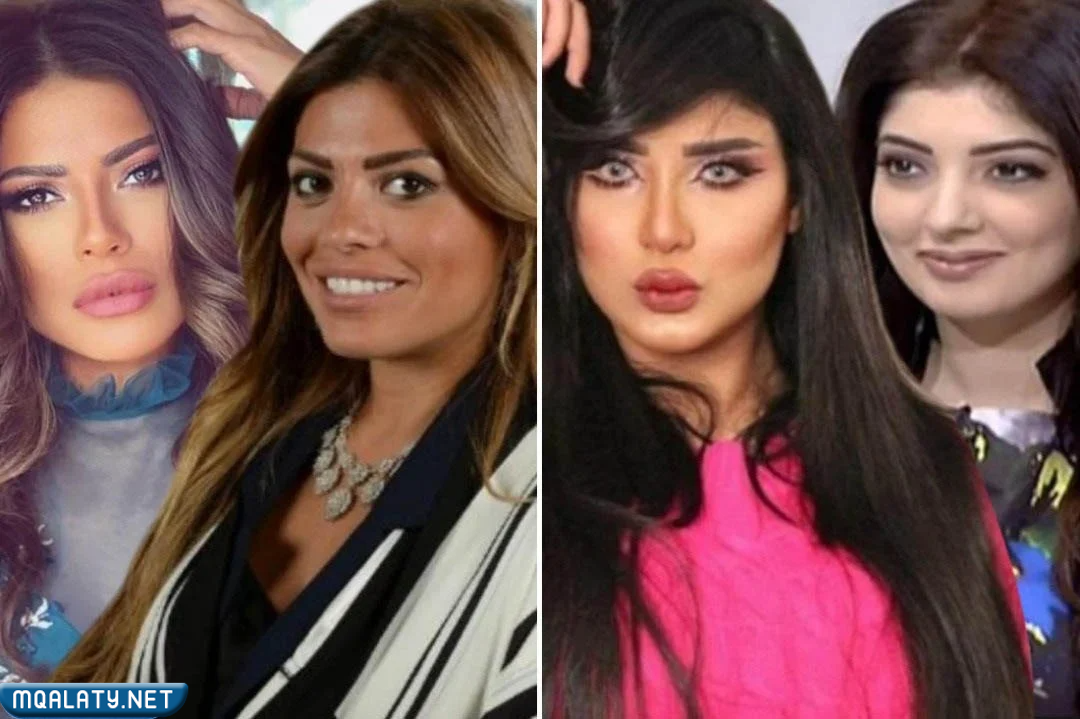 عهود العنزي قبل وبعد عمليات التجميل