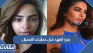 فوز الفهد قبل عمليات التجميل وبعدها