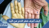 كيف أعرف فقر الدم من اليد