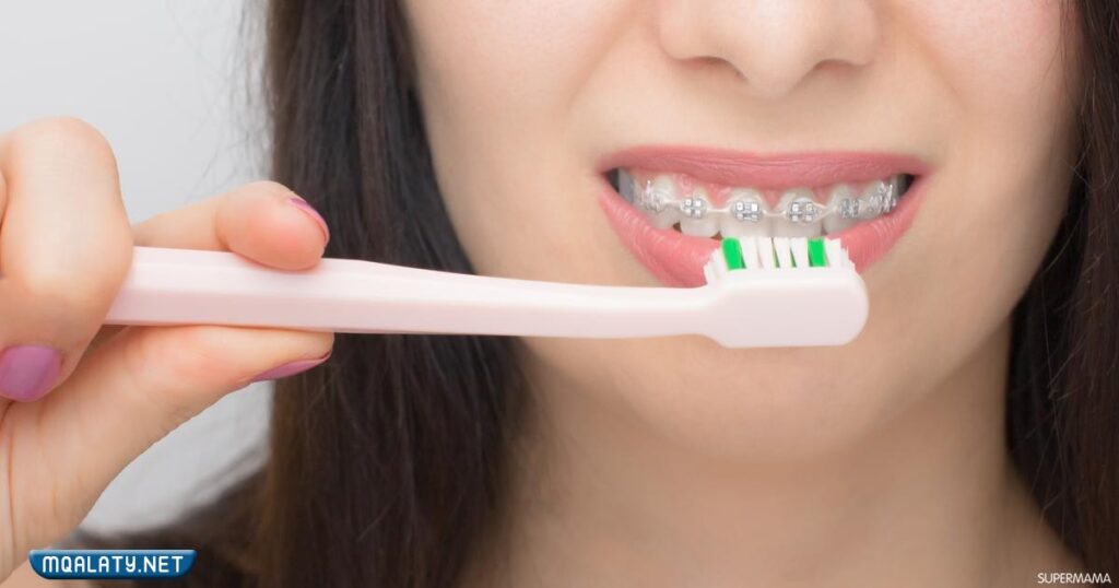 افضل معجون اسنان للتقويم الثابت