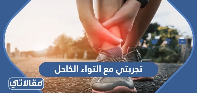 تجربتي مع التواء الكاحل