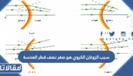 سبب الزوغان الكروي هو صغر نصف قطر العدسة