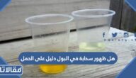 هل ظهور سحابة في البول دليل على الحمل
