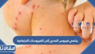 ينتمي فيروس الجدري الى الفيروسات الارتجاعية صح ام خطا