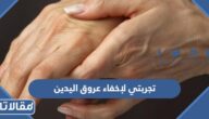 تجربتي لإخفاء عروق اليدين