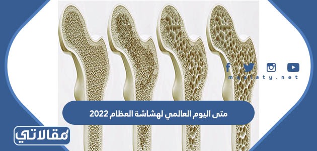 متى اليوم العالمي لهشاشة العظام 2023
