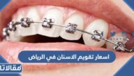 اسعار تقويم الاسنان في الرياض 2025