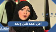 صور امل احمد قبل وبعد التجميل