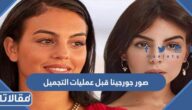 صور جورجينا قبل عمليات التجميل